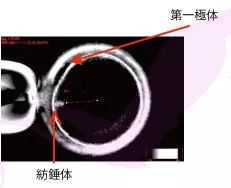通过XY精子分离术实现生男孩的可行性分析